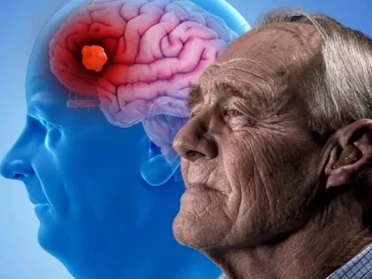 Cuál es el alimento que Harvard recomienda para prevenir el Alzheimer